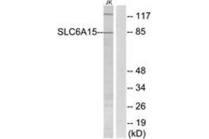 Western blot analysis of extracts from Jurkat cells, using SLC6A15 Antibody. (SLC6A15 抗体  (AA 32-81))