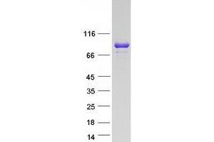 Validation with Western Blot