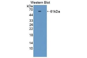 Detection of Recombinant PRCP, Mouse using Polyclonal Antibody to Prolylcarboxypeptidase (PRCP) (PRCP 抗体  (AA 169-443))