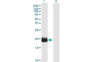 Western Blot analysis of IFT20 expression in transfected 293T cell line by IFT20 monoclonal antibody (M02), clone 3F3.