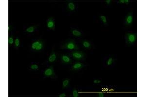 Immunofluorescence (IF) image for anti-Polo-Like Kinase 1 (PLK1) (AA 1-603) antibody (ABIN562277)