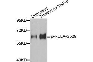 Western Blotting (WB) image for anti-Nuclear Factor-kB p65 (NFkBP65) (pSer529) antibody (ABIN1870581) (NF-kB p65 抗体  (pSer529))