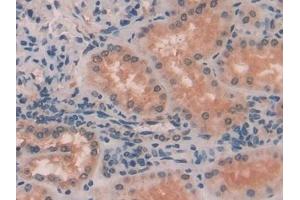 Detection of MYLK in Human Kidney Tissue using Polyclonal Antibody to Myosin Light Chain Kinase (MYLK) (MYLK 抗体  (AA 1661-1877))