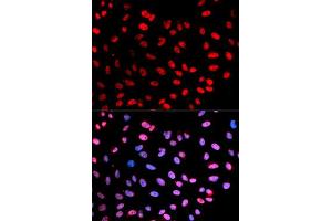 Immunofluorescent staining of U-2 OS cells with ESPL1 (phospho S1126) polyclonal antibody  at 1:20-1:100 dilution. (Separase 抗体  (pSer1126))