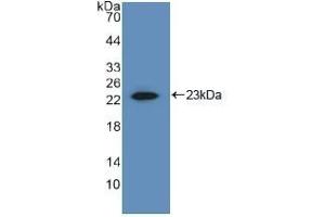 Detection of Recombinant MMP1, Human using Polyclonal Antibody to Matrix Metalloproteinase 1 (MMP1) (MMP1 抗体  (AA 98-275))