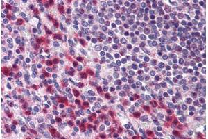 Human Spleen (formalin-fixed, paraffin-embedded) stained with BCLAF1 antibody ABIN296759 at 10 ug/ml followed by biotinylated goat anti-rabbit IgG secondary antibody ABIN481713, alkaline phosphatase-streptavidin and chromogen. (BCLAF1 抗体  (AA 700-750))