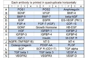 Image no. 1 for Human Growth Factor Array Q1 (ABIN625732) (人 Growth Factor Array Q1)