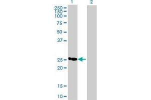 Western Blot analysis of C19orf43 expression in transfected 293T cell line by C19orf43 MaxPab polyclonal antibody. (C19orf43 抗体  (AA 1-176))