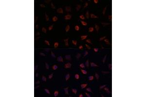 Immunofluorescence analysis of L929 cells using F antibody (ABIN6131636, ABIN6140414, ABIN6140415 and ABIN6220935) at dilution of 1:100. (FABP1 抗体  (AA 1-127))