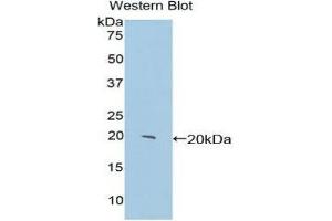 Western Blotting (WB) image for anti-Centromere Protein E, 312kDa (CENPE) (AA 2222-2361) antibody (ABIN1858364)