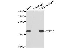 Immunoprecipitation analysis of 150ug extracts of MCF7 cells using 3ug TCEB2 antibody. (TCEB2 抗体  (AA 1-118))