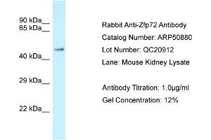 WB Suggested Anti-Zfp72 Antibody   Titration: 1. (Zfp72 抗体  (N-Term))