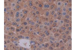DAB staining on IHC-P; Samples: Mouse Liver Tissue (EBI3 抗体  (AA 19-228))