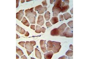 Immunohistochemistry analysis in formalin fixed and paraffin embedded skeletal muscle reacted with PATL1 Antibody (C-term) followed which was peroxidase conjugated to the secondary antibody and followed by DAB staining. (PATL1 抗体  (C-Term))