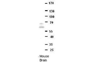 DONSON antibody - middle region  validated by WB using Mouse brains at 1:1000. (DONSON 抗体  (Middle Region))