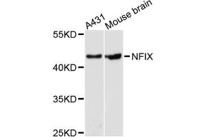 Western blot analysis of extracts of various cell lines, using NFIX antibody. (NFIX 抗体)
