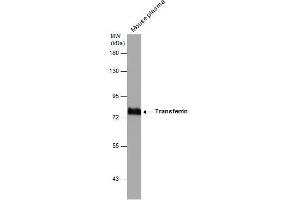 WB Image Mouse tissue extract (50 μg) was separated by 7. (Transferrin 抗体)