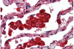 Human Lung: Formalin-Fixed, Paraffin-Embedded (FFPE) (Caspase 12 抗体)