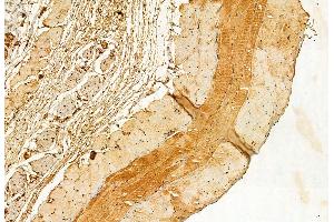 ABIN6262483 and ABIN6272845 at 1/100 staining Mouse skin tissue by IHC-P.
