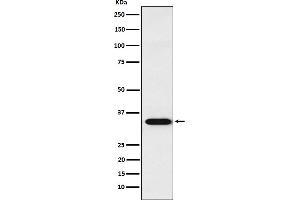 Western blot analysis of APRIL expression in Jurkat cell lysate.