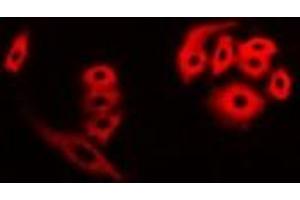 Immunofluorescent analysis of FHR3 staining in A549 cells. (CFHR3 抗体)
