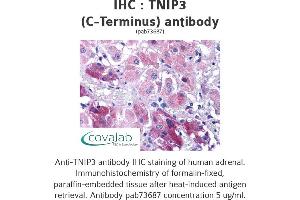 Image no. 1 for anti-TNFAIP3 Interacting Protein 3 (TNIP3) (C-Term) antibody (ABIN1740204) (TNIP3 抗体  (C-Term))