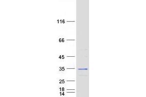 Western Blotting (WB) image for SCO1 Cytochrome C Oxidase Assembly Protein (SCO1) protein (Myc-DYKDDDDK Tag) (ABIN2731497)