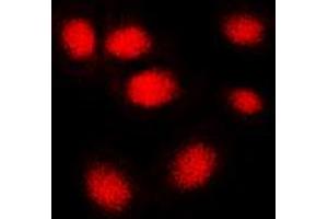 Immunofluorescent analysis of hNRNP C staining in MCF7 cells. (HNRNPC 抗体  (C-Term))