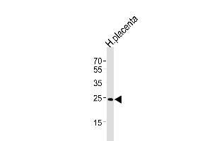 Western blot analysis of lysate from human placenta tissue lysate, using ANP32B Antibody (N-term) (ABIN1539101 and ABIN2848657). (ANP32B 抗体  (N-Term))