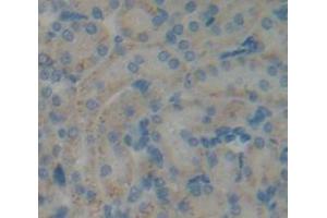 IHC-P analysis of Kidney tissue, with DAB staining. (COQ6 抗体  (AA 1-476))