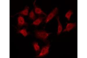 ABIN6275988 staining HepG2 by IF/ICC. (GPR37L1 抗体  (N-Term))