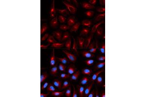 Immunofluorescence (IF) image for anti-Transducin-Like Enhancer of Split 1 (E(sp1) Homolog, Drosophila) (TLE1) antibody (ABIN1876687) (TLE1 抗体)
