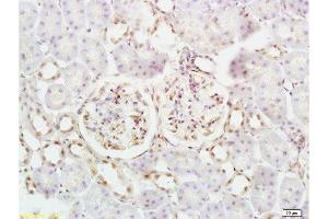Formalin-fixed and mouse kidney tissue labeled with Anti-Defensin-beta2/DEFB2/HBD-2 Polyclonal Antibody, Unconjugated  at 1:200 followed by conjugation to the secondary antibody and DAB staining (beta 2 Defensin 抗体  (AA 21-71))