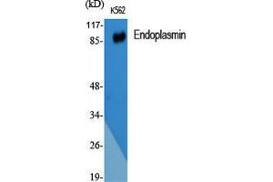 Western Blot (WB) analysis of specific cells using Endoplasmin Polyclonal Antibody. (GRP94 抗体  (C-Term))