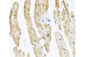Immunohistochemistry of paraffin-embedded Rat heart using COPB2 Polyclonal Antibody at dilution of 1:100 (40x lens). (COPB2 抗体)
