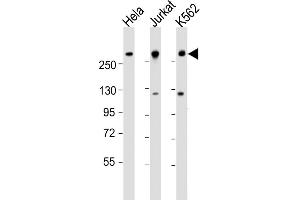 All lanes : Anti-CHD3 Antibody (N-Term) at 1:1000-1:2000 dilution Lane 1: Hela whole cell lysate Lane 2: Jurkat whole cell lysate Lane 3: K562 whole cell lysate Lysates/proteins at 20 μg per lane. (CHD3 抗体  (AA 595-629))