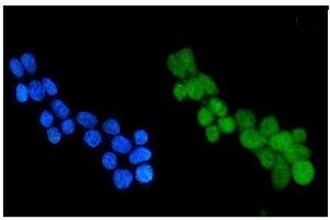 IF analysis of HDAC4 using anti-HDAC4 antibody (ABIN5518841). (HDAC4 抗体  (AA 4-213))