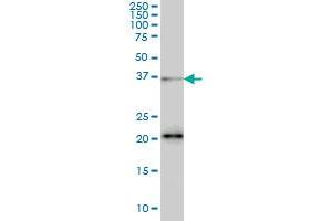 Western Blotting (WB) image for anti-serine/arginine-Rich Splicing Factor 10 (SRSF10) (AA 1-101) antibody (ABIN599153) (SRSF10 抗体  (AA 1-101))