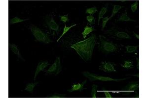 Immunofluorescence of monoclonal antibody to CASP10 on HeLa cell. (Caspase 10 抗体  (AA 1-110))