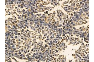 TBK1 Mouse Monoclonal Antibody at 1/100 staining mouse testis tissue by IHC-P.