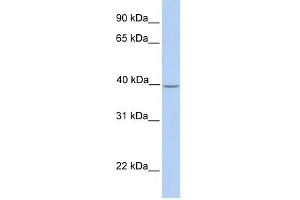 SAMSN1 antibody used at 1 ug/ml to detect target protein. (SAMSN1 抗体  (Middle Region))