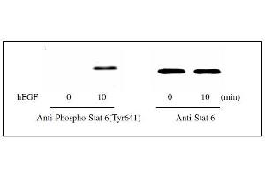 Western blot analysis of extracts from 100 ng/mL hEGF treated A431 cells. (STAT6 ELISA 试剂盒)