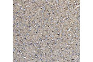 IHC analysis of CD90/Thy1 using anti-CD90/Thy1 antibody (ABIN5518877). (CD90 抗体  (AA 20-131))