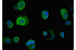 Immunofluorescent analysis of MCF-7 cells using ABIN7156348 at dilution of 1:100 and Alexa Fluor 488-congugated AffiniPure Goat Anti-Rabbit IgG(H+L) (INSIG1 抗体  (AA 1-87))