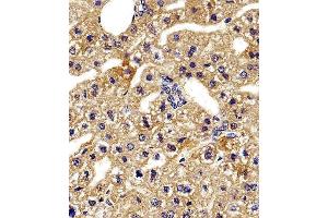Immunohistochemistry (Paraffin-embedded Sections) (IHC (p)) image for anti-Hemoglobin, gamma G (HBG2) (AA 101-133), (C-Term) antibody (ABIN1944740)