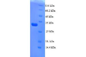SDS-PAGE (SDS) image for Angiotensin II Receptor, Type 2 (AGTR2) (AA 1-45), (Extracellular) protein (GST tag) (ABIN5709011)