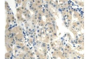 Immunohistochemistry (IHC) image for anti-Calmodulin Like Protein 3 (CALML3) (AA 1-149) antibody (ABIN7436177)