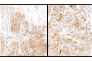 anti-TS (C-Term) antibody