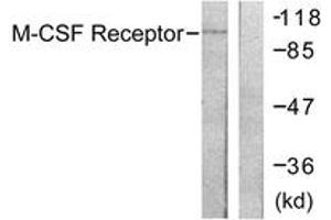 Western Blotting (WB) image for anti-Colony Stimulating Factor 1 Receptor (CSF1R) (AA 781-830) antibody (ABIN2888675) (CSF1R 抗体  (AA 781-830))