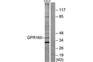 Western blot analysis of extracts from COLO205 cells, using GPR160 Antibody. (GPR160 抗体  (AA 289-338))